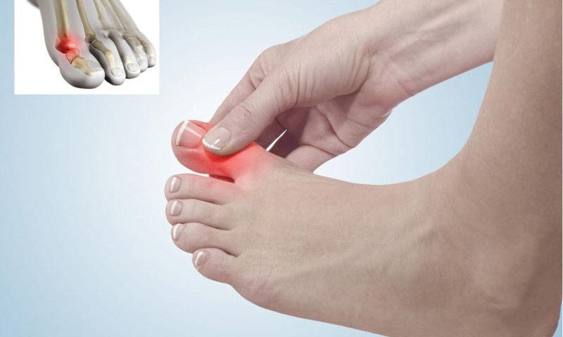پادرد و متاتارسالژیا: علل، علائم و روش‌های درمان